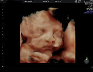 BFPs after IVF - navigating pregnancy - pt 2!