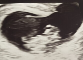IVFers Due Mar & Apr 2023