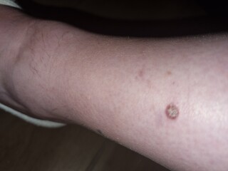 Strange lump pic included 