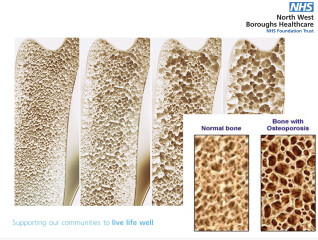 Teen Eating Disorders - Thread 6