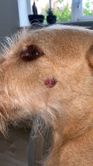 How long for needle biopsy results