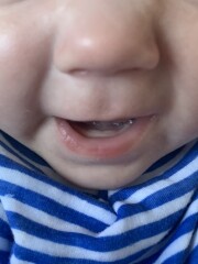 Is he teething?