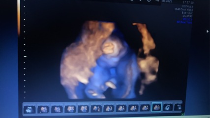 Just for fun..nub theory..anyone guess?
