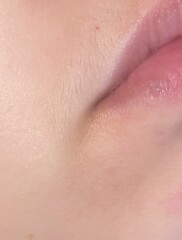 What is this lump on my lip 