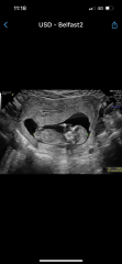 Due March 2023 - thread 2 
