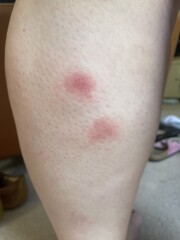 What is biting me?! With pics 