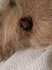 How long for needle biopsy results