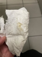 Implantation or infection?
