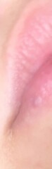 What is this lump on my lip 
