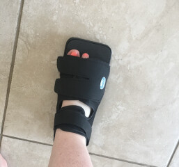Does my toe look broken?
