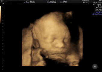 BFPs after IVF - navigating pregnancy - pt 2!