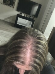 Hair 