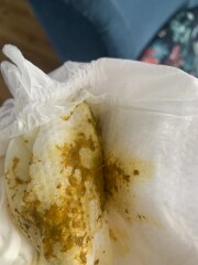 Newborn CMPA poo? (Pics)