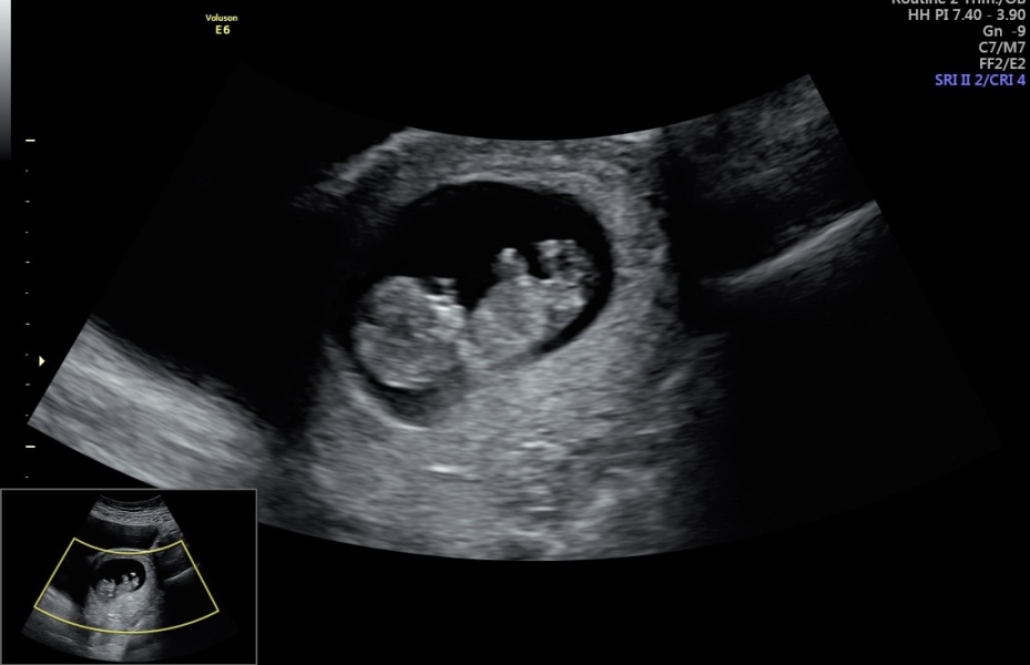 Babies Due April 2023 thread 5