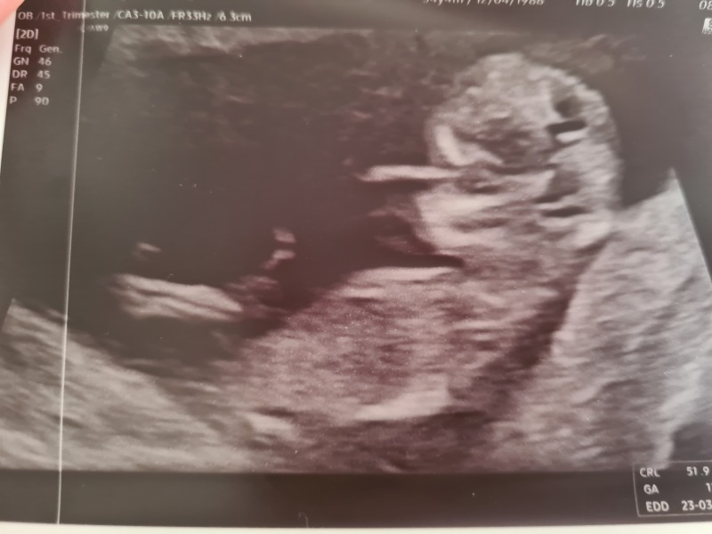 Due March 2023 - thread 3