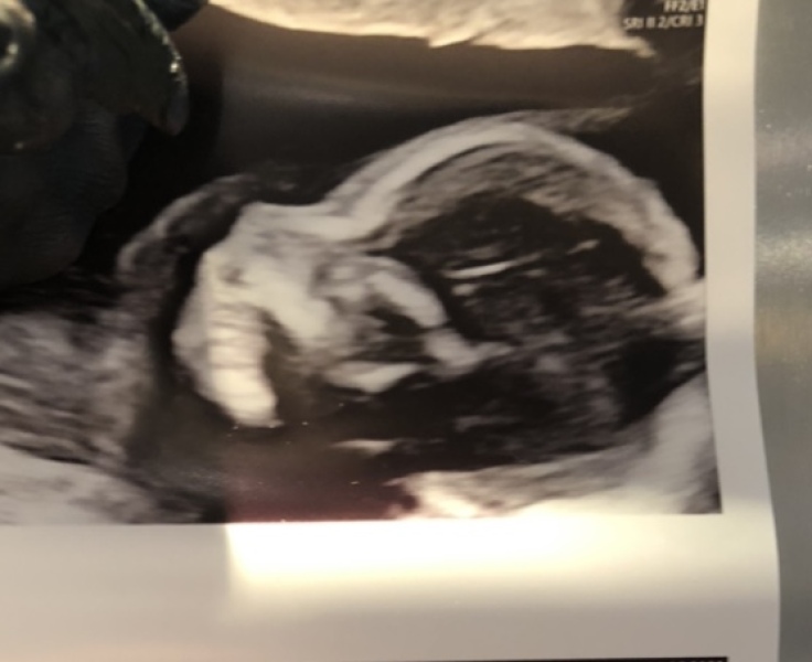 Boy or Girl?
