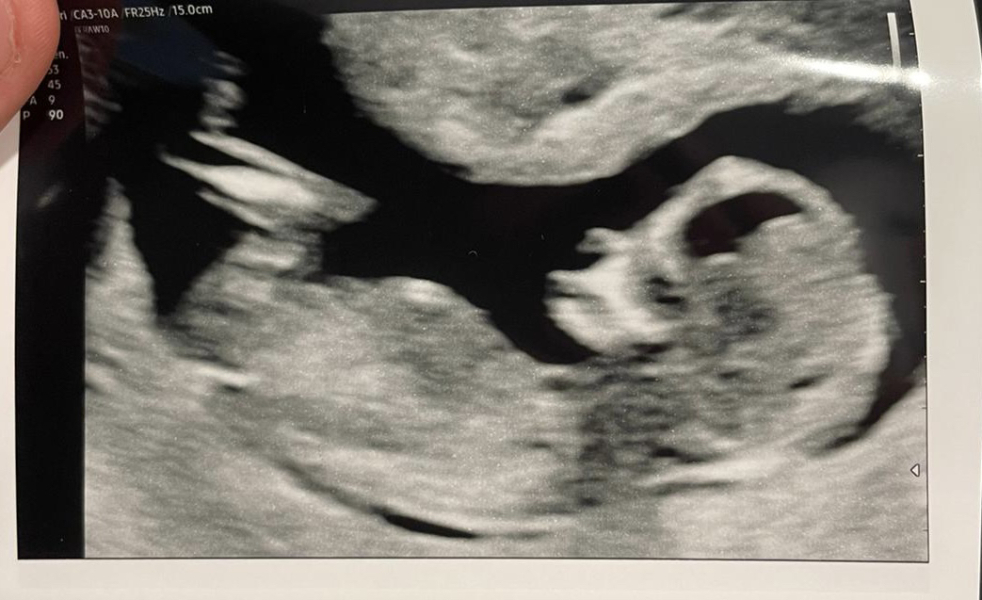 Due March 2023 - thread 3