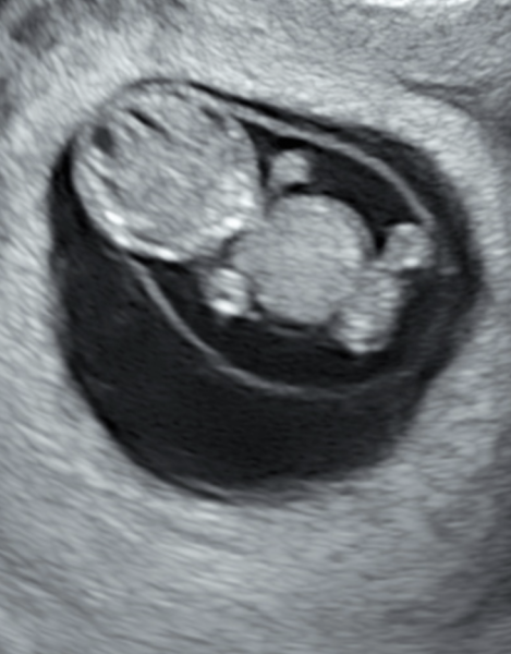 Babies Due April 2023 thread 5