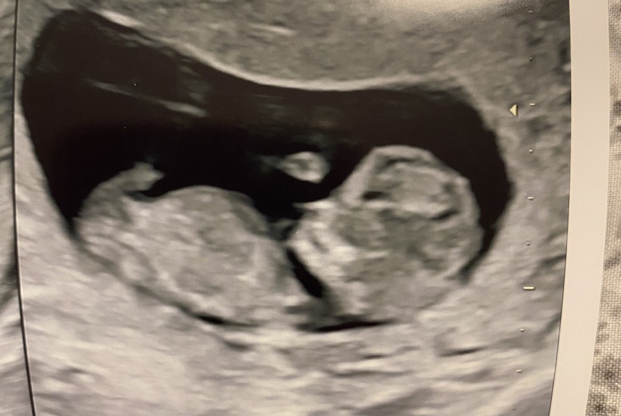 Babies Due April 2023 thread 5