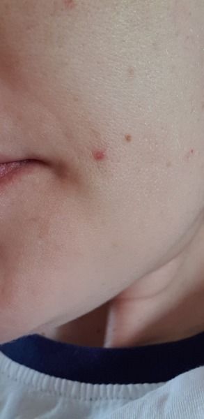 This thing on my face has a pulse!