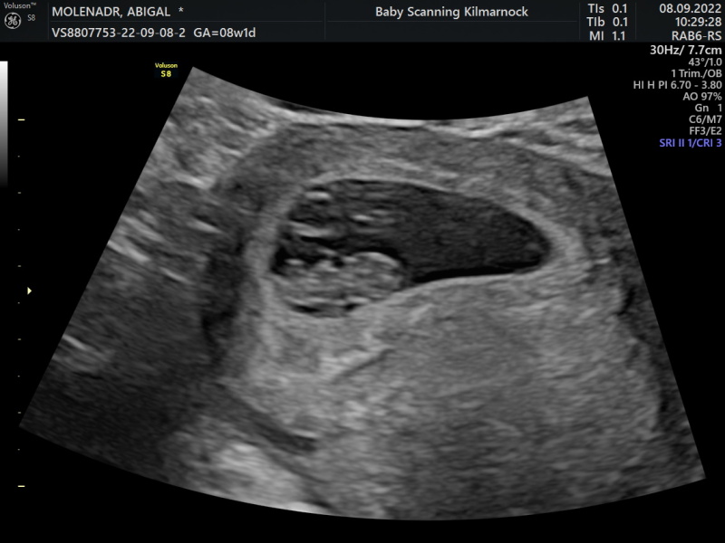 Babies Due April 2023 Thread 4 