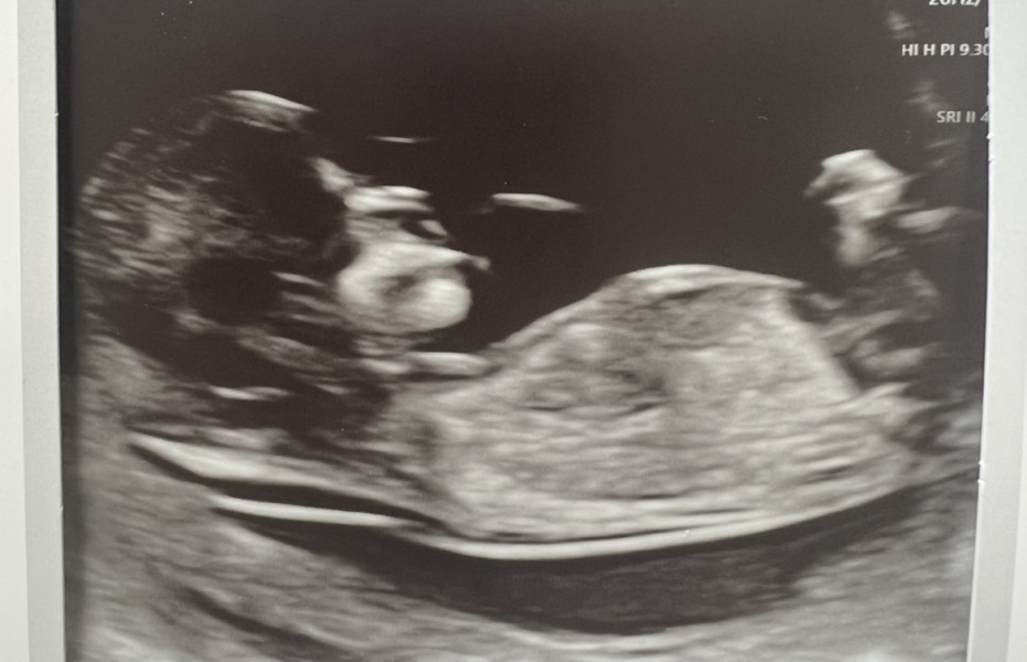12 week scan guesses - will find out next week!