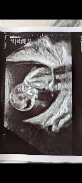 Babies Due April 2023 thread 5