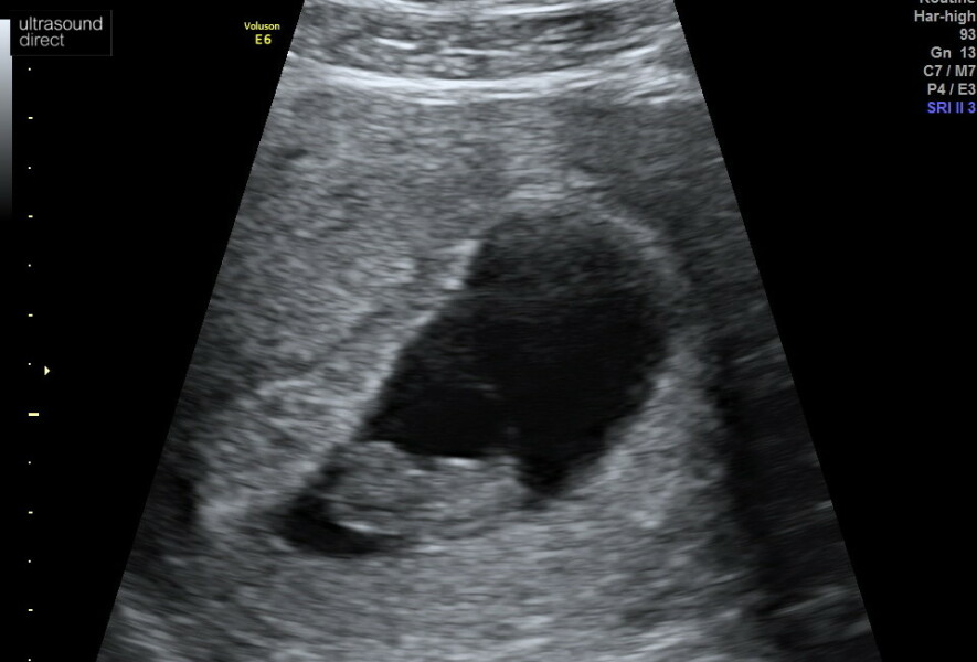 Babies Due April 2023 Thread 4 