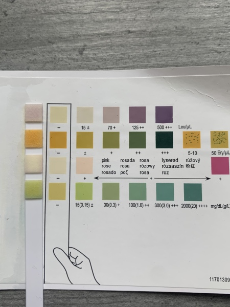 Urine dip test 