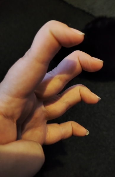 Can you do this to your arm? *PICTURE ATTACHED *