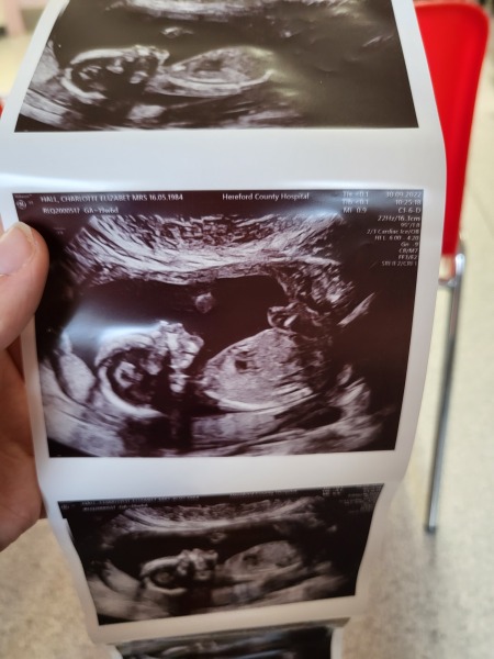 Due Feb/Mar after MC 🌈 🙈 Thread 2