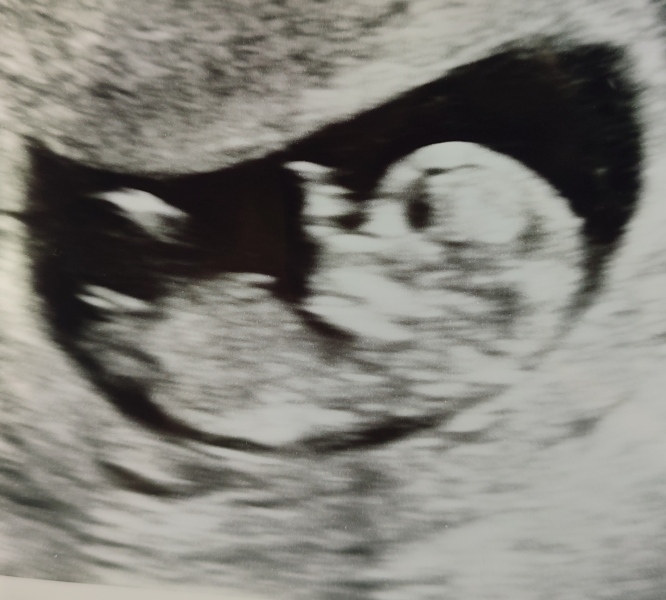 Babies Due April 2023 thread 5
