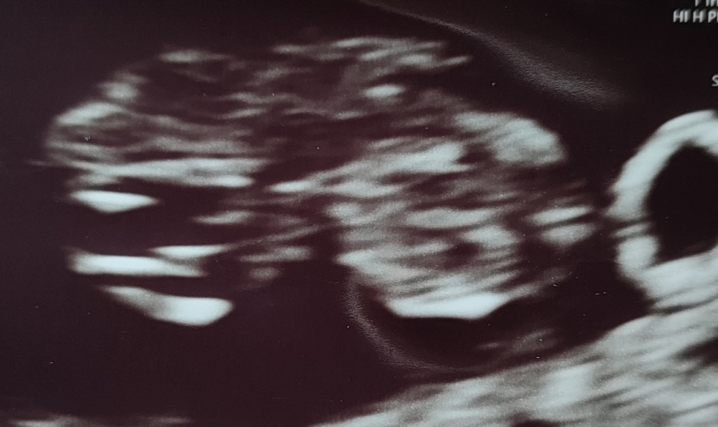 Babies Due April 2023 Thread 4 