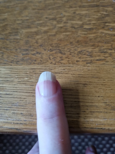 White of nails