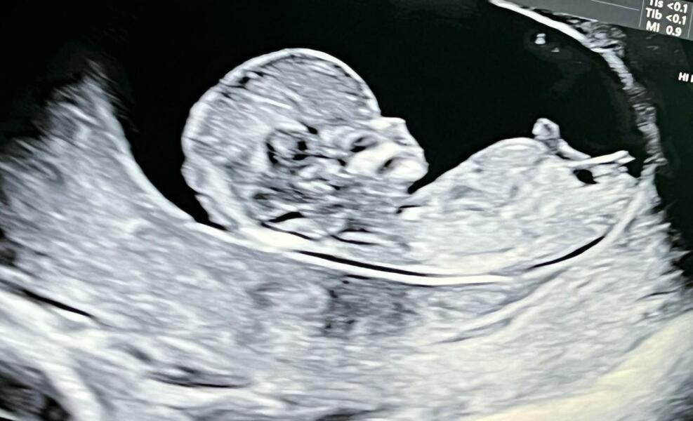 Due March 2023 - thread 3