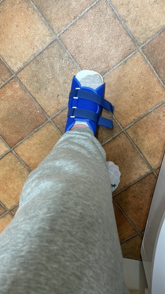 Fractured foot, getting much worse, severe pain and swelling 6 weeks on. Can’t walk.