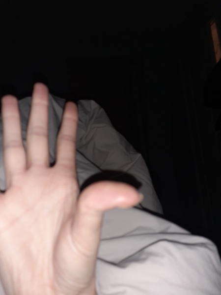 Can you do this to your arm? *PICTURE ATTACHED *