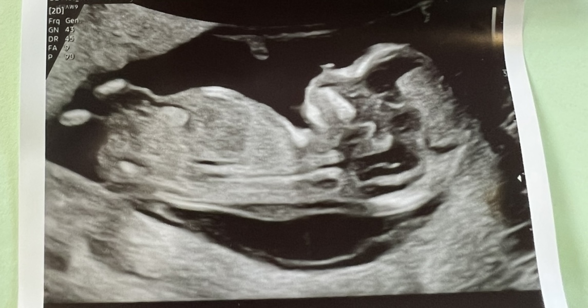 Babies Due April 2023 thread 5
