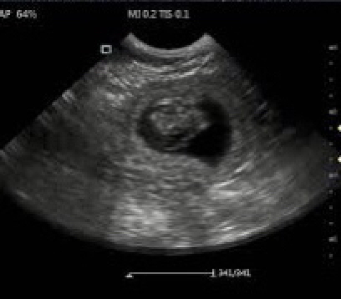 Is anyone on here pro-life?