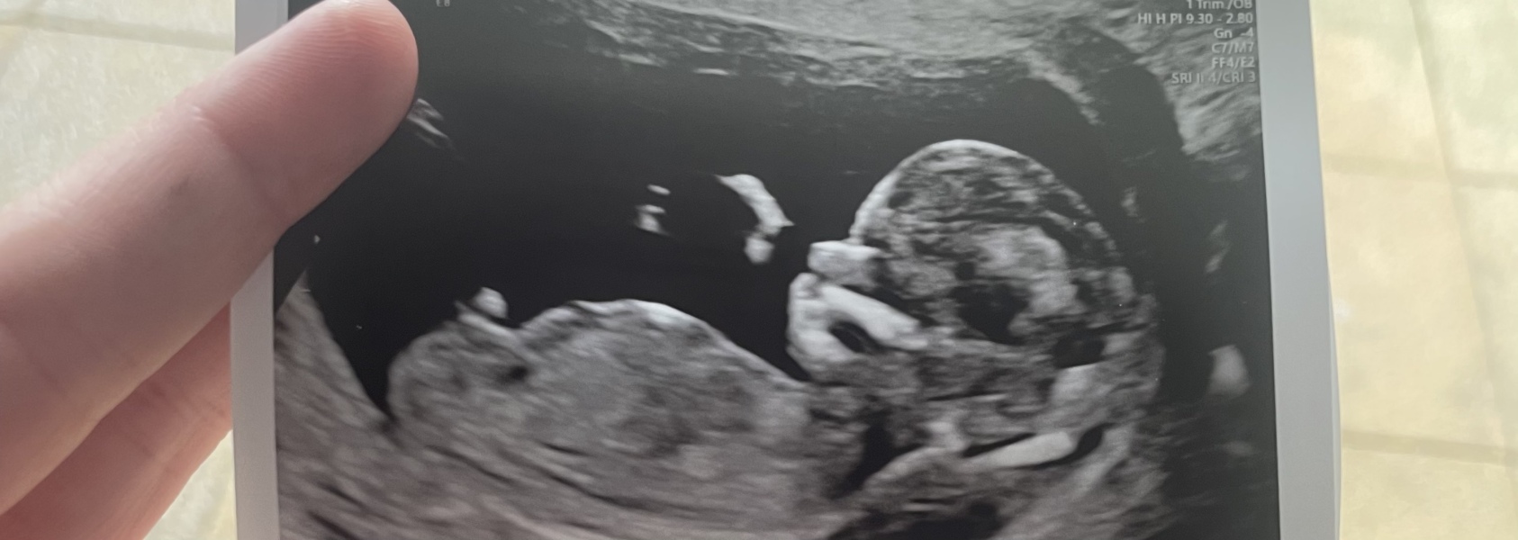 13 weeks!