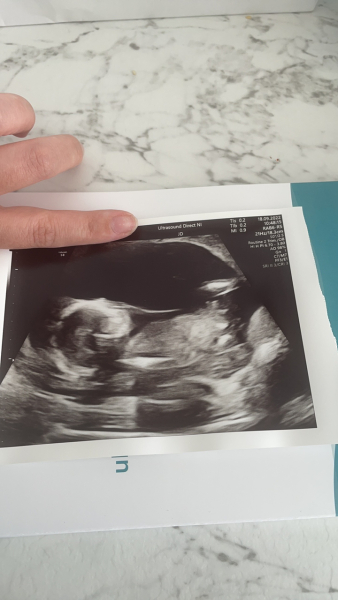 Due March 2023 - thread 3