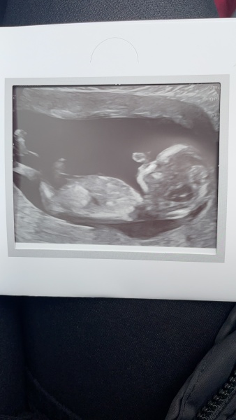 Babies Due April 2023 thread 5