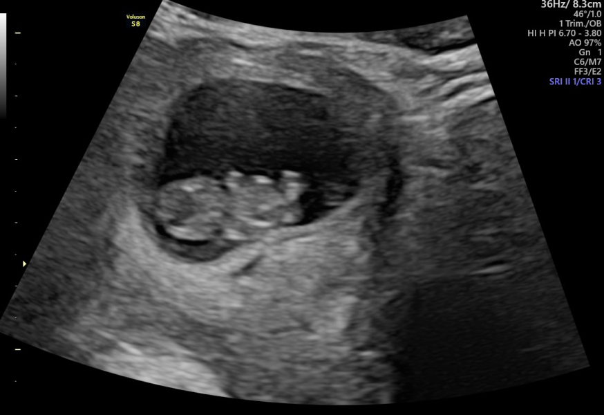 Babies Due April 2023 Thread 4 