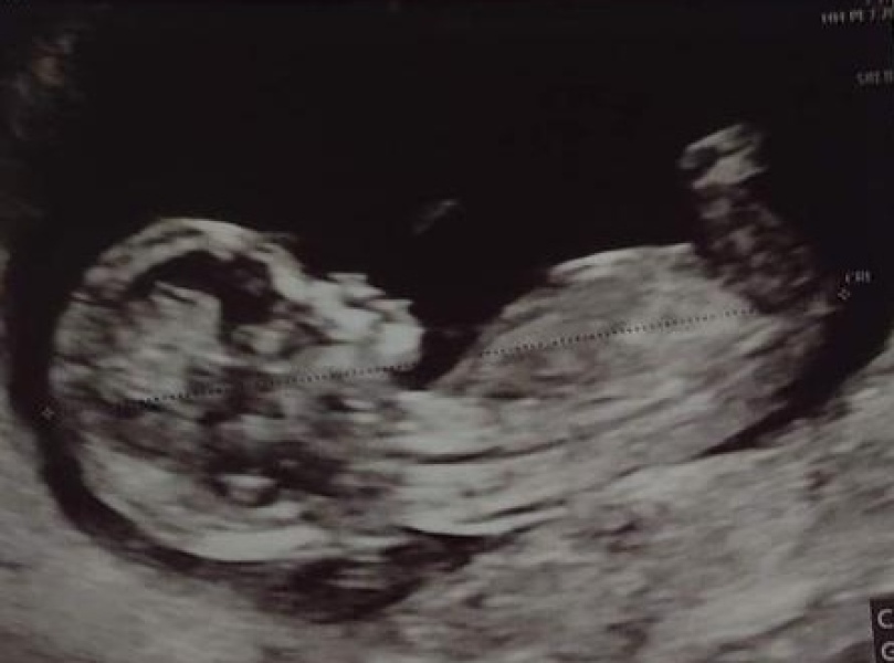 Just for fun - gender guesses