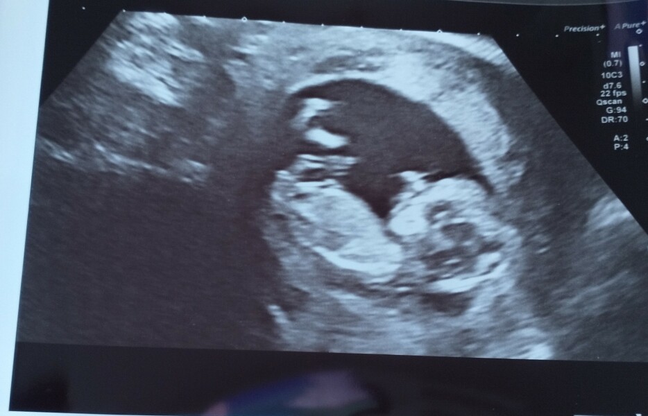 IVFers Due Mar & Apr 2023