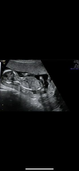 Girl or boy?