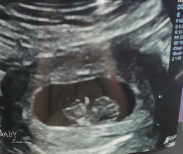 Babies Due April 2023 thread 5