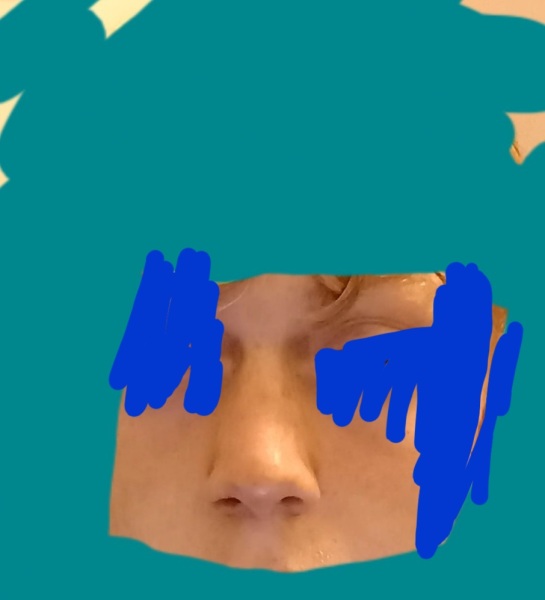 Is my son's nose broken?
