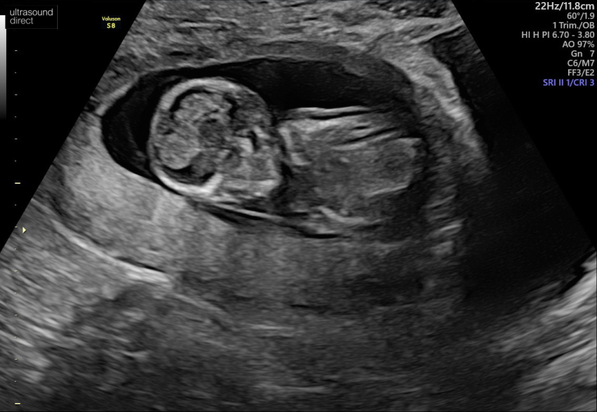 Due March 2023 - thread 3