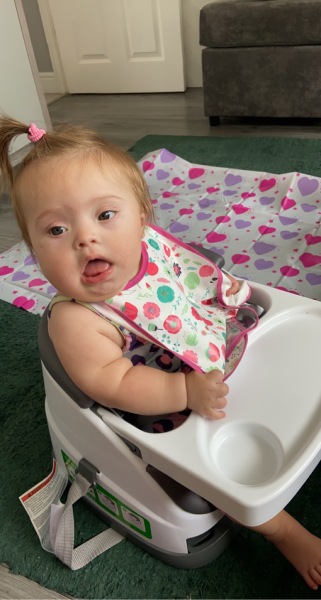 Down Syndrome diagnosis after birth 